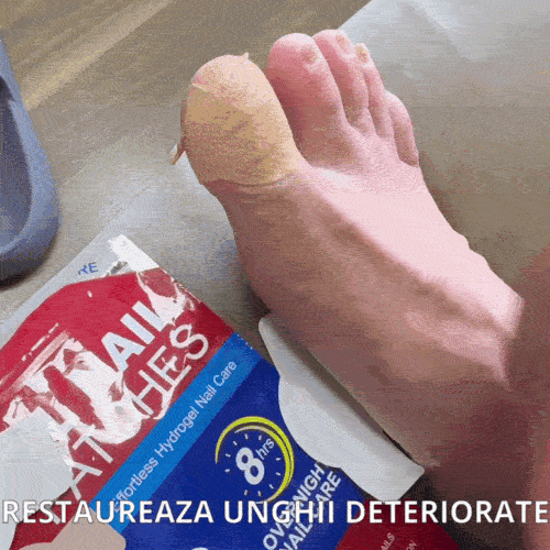 Plasturi pentru unghii sănătoase